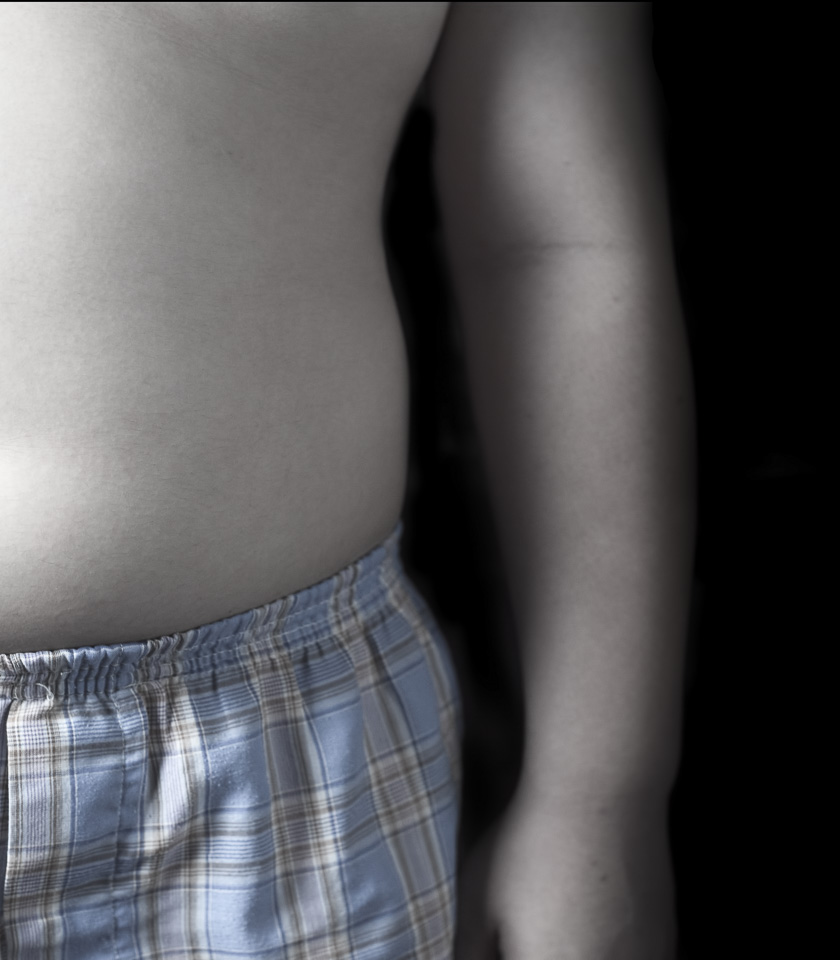 Κοντινή φωτογραφία με παχύσαρκο αγόρι