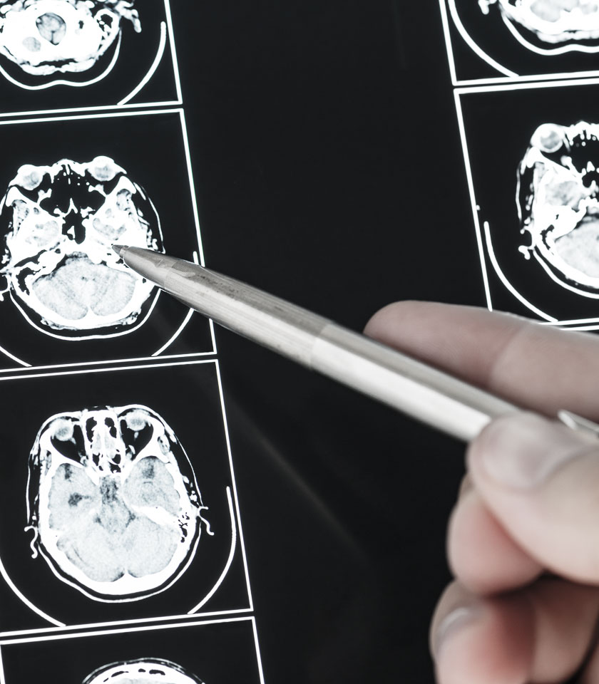 Magnetic resonance imaging of the brain